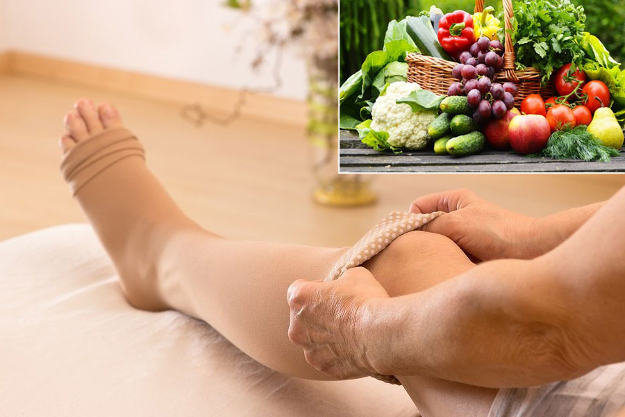 Bioflavonoids for varicose veins