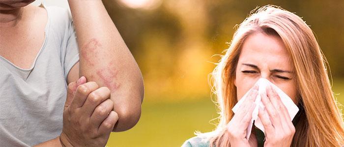 Beneficios de quercetina para la alergia